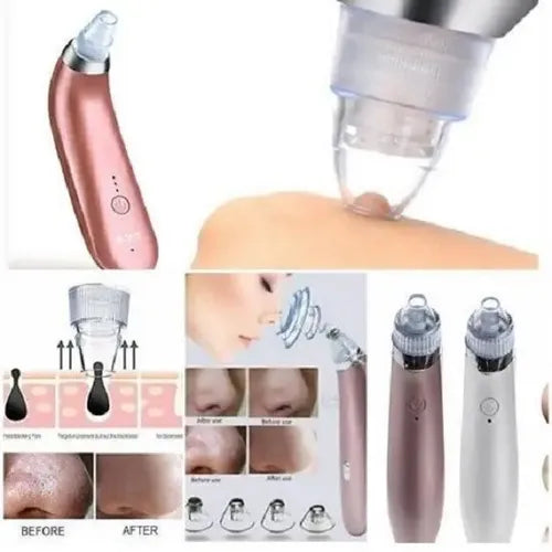 Limpiador Facial de Poros por Succión XN-8030